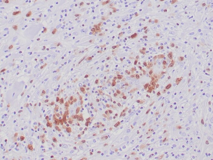 ALK/CD246 Antibody (ALK1/6698R)