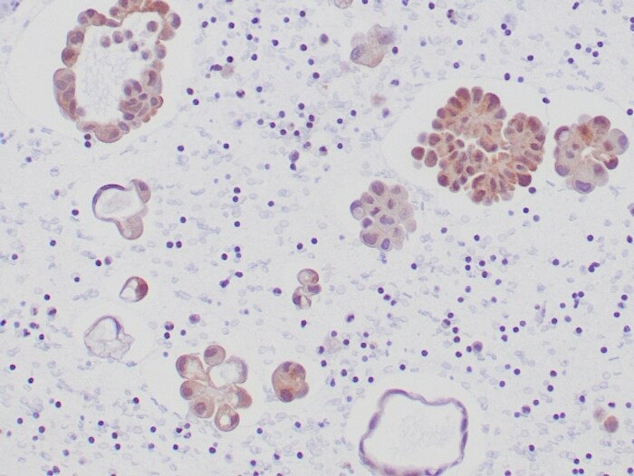 ALK/CD246 Antibody (ALK1/6698R)