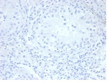 Alkaline Phosphatase/ALPP/ALPI Antibody (rALP/870)