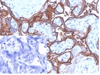 Alkaline Phosphatase/ALPP/ALPI Antibody (ALPP/4109)