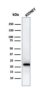 Ferritin Light Chain Antibody (rFTL/1388)