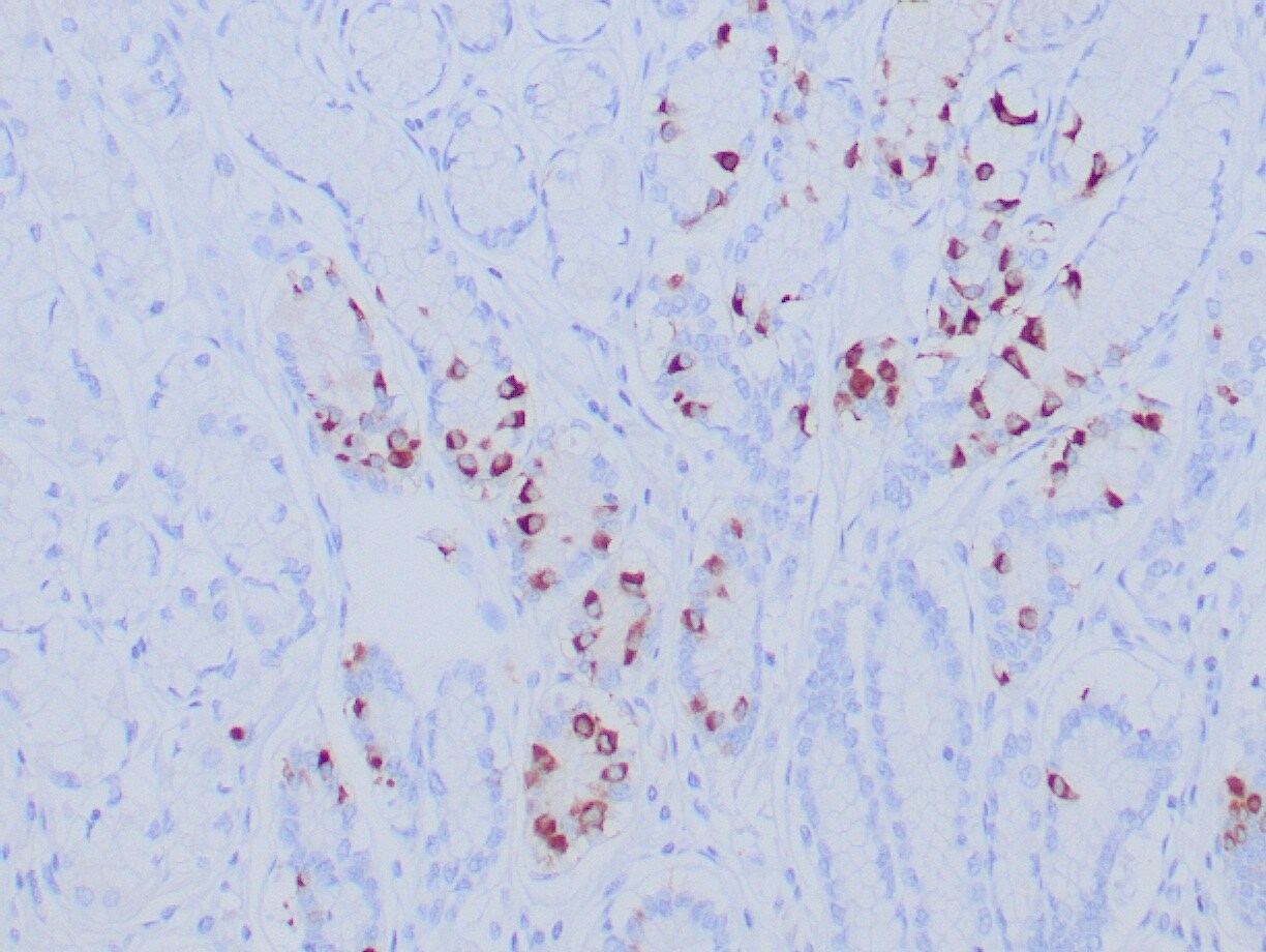 Gastrin Antibody (GAST/8646R)