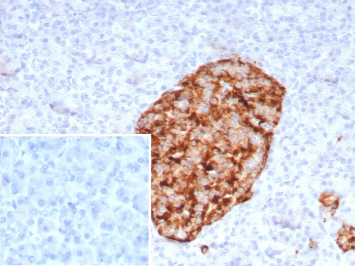 GAD2/GAD65 Antibody (rGAD2/9382)