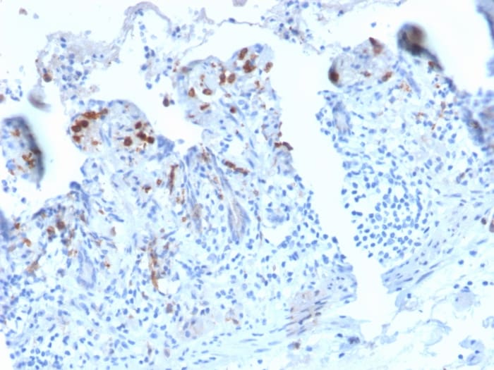 DC-SIGN/CD209 Antibody (C209/2749R)