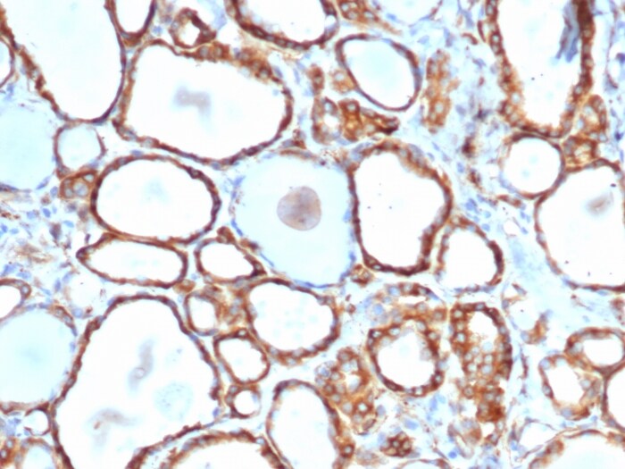 HSP27 Antibody (rHSPB1/6489)