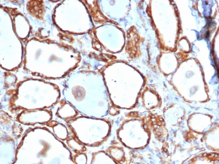 HSP27 Antibody (HSPB1/6490R)