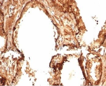 HSP27 Antibody (HSPB1/7038R)