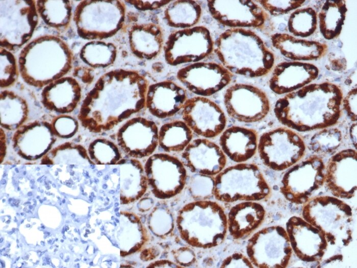 HSP60 Antibody (rHSPD1/6497)