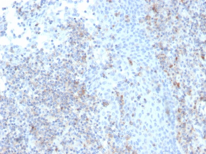 ICAM-3/CD50 Antibody (rICAM3/1019)