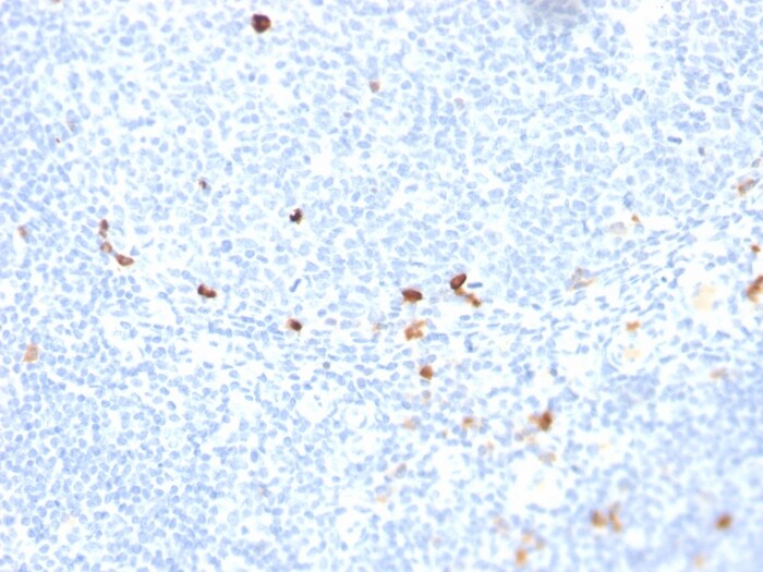 IgM Antibody (rIGHM/1623)