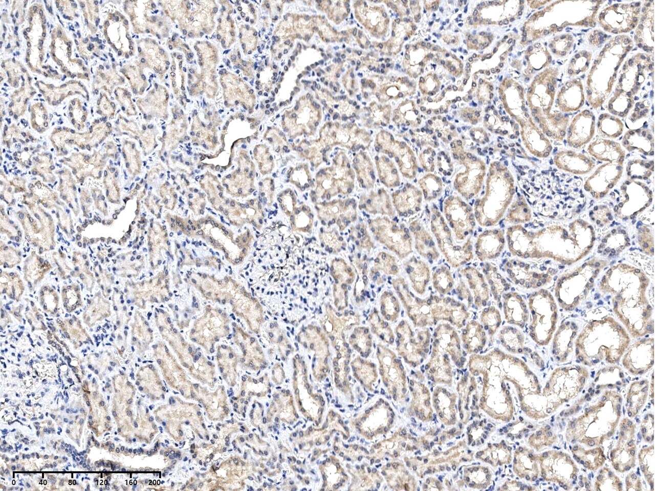 PXMP4 Antibody - Azide and BSA Free PXMP4 Antibody - Azide and BSA Free