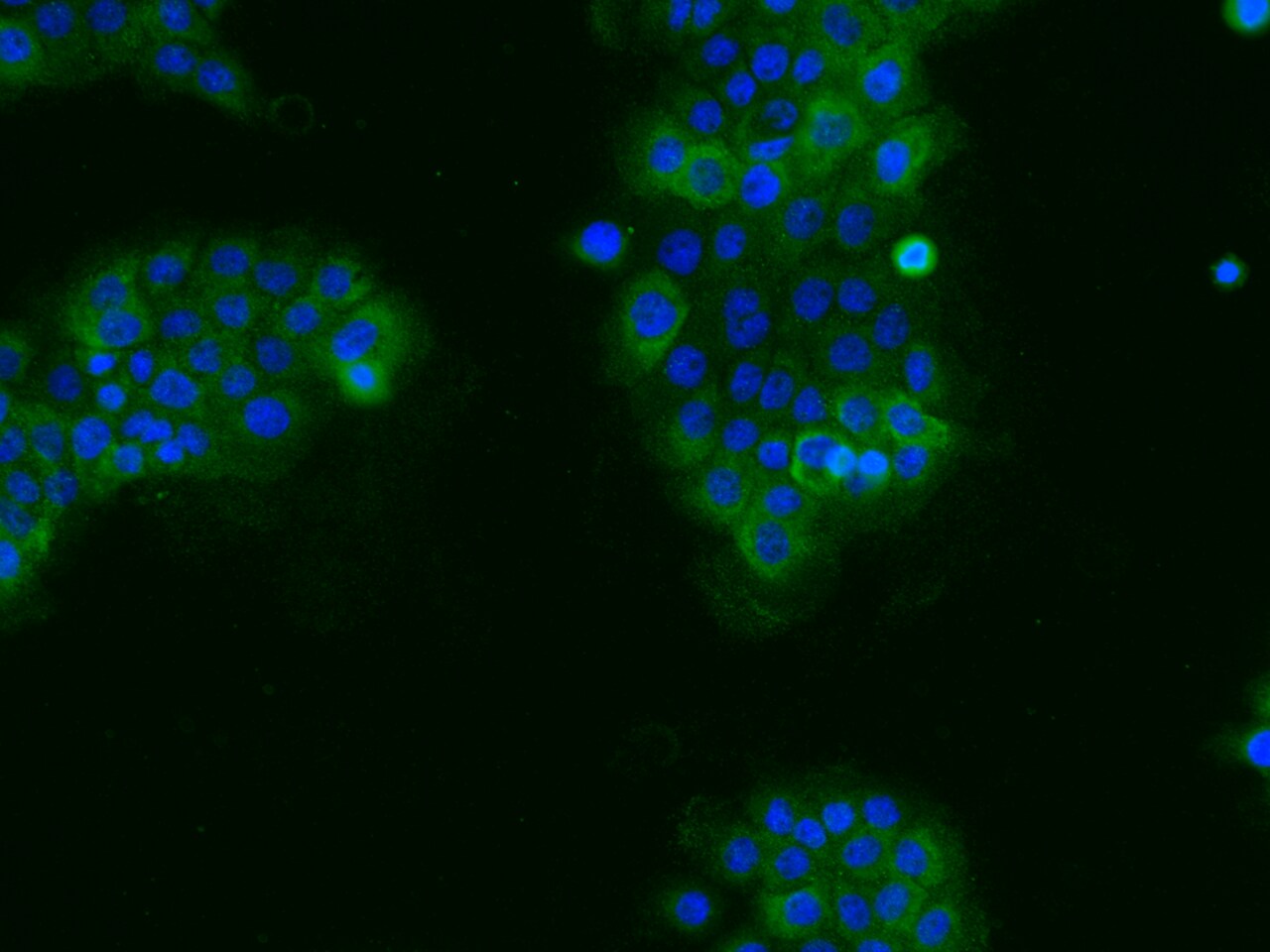 XK X-linked Kx blood group Antibody - Azide and BSA Free XK X-linked Kx blood group Antibody - Azide and BSA Free