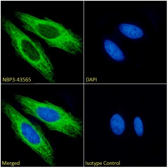 Cytokeratin 17 Antibody (4D2) - Chimeric - BSA Free Cytokeratin 17 Antibody (4D2) - Chimeric - BSA Free