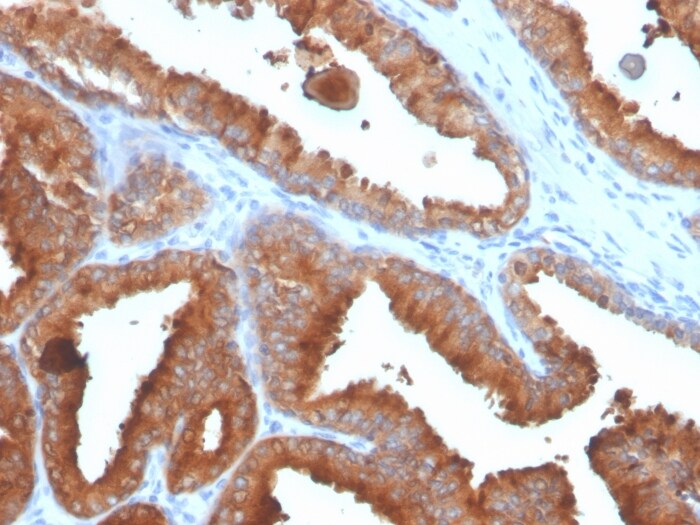 Kallikrein 3/PSA Antibody (rKLK3/4753) - Azide and BSA Free