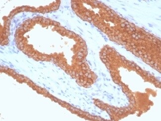 Kallikrein 3/PSA Antibody (KLK3/7128R) - Azide and BSA Free