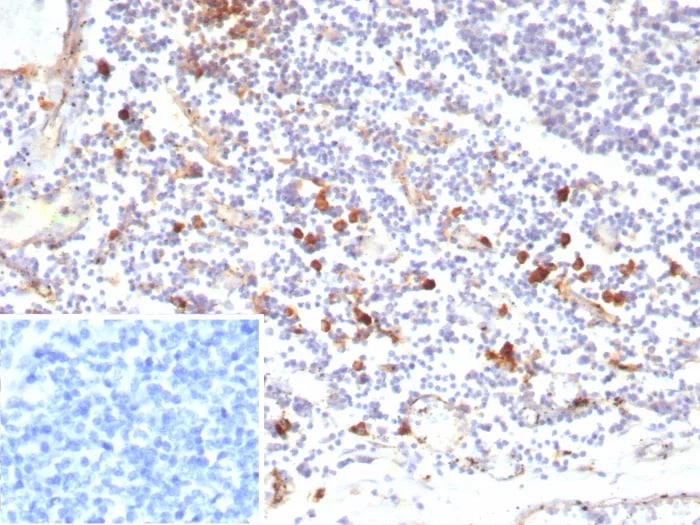 IL-3R alpha/CD123 Antibody (rIL3RA/9212) - Azide and BSA Free