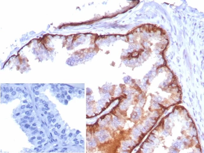 Cytokeratin 5 Antibody (KRT5/8814R) - Azide and BSA Free
