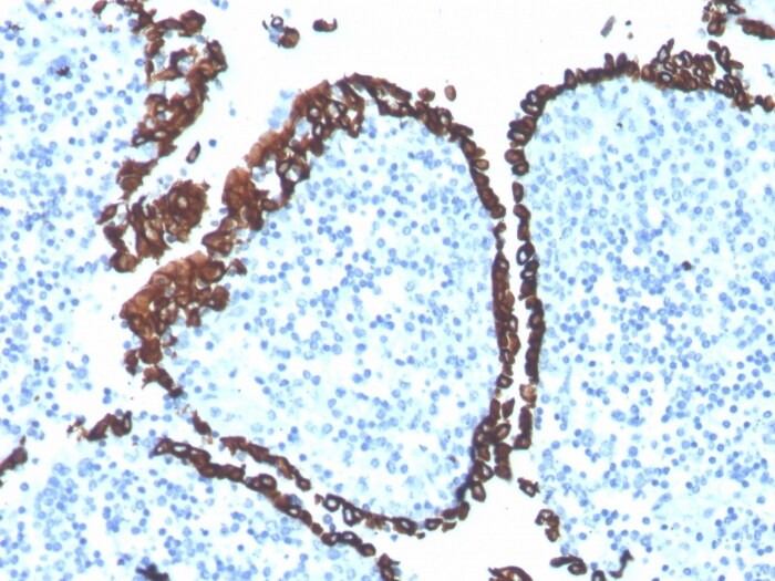 Cytokeratin 5 Antibody (KRT5/4245R) - Azide and BSA Free