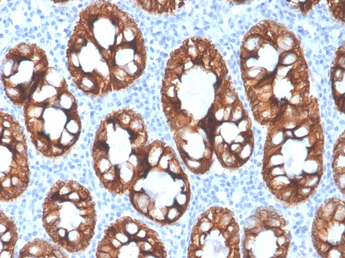 Cytokeratin 8 Antibody (rKRT8/4209) - Azide and BSA Free