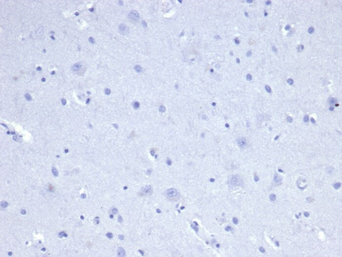 Cytokeratin 8 Antibody (rKRT8/4209) - Azide and BSA Free