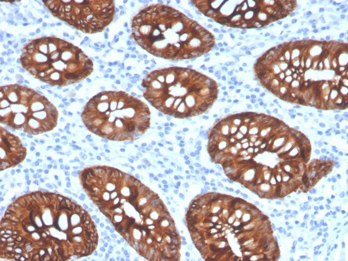 Cytokeratin 8 Antibody (KRT8/4067R) - Azide and BSA Free