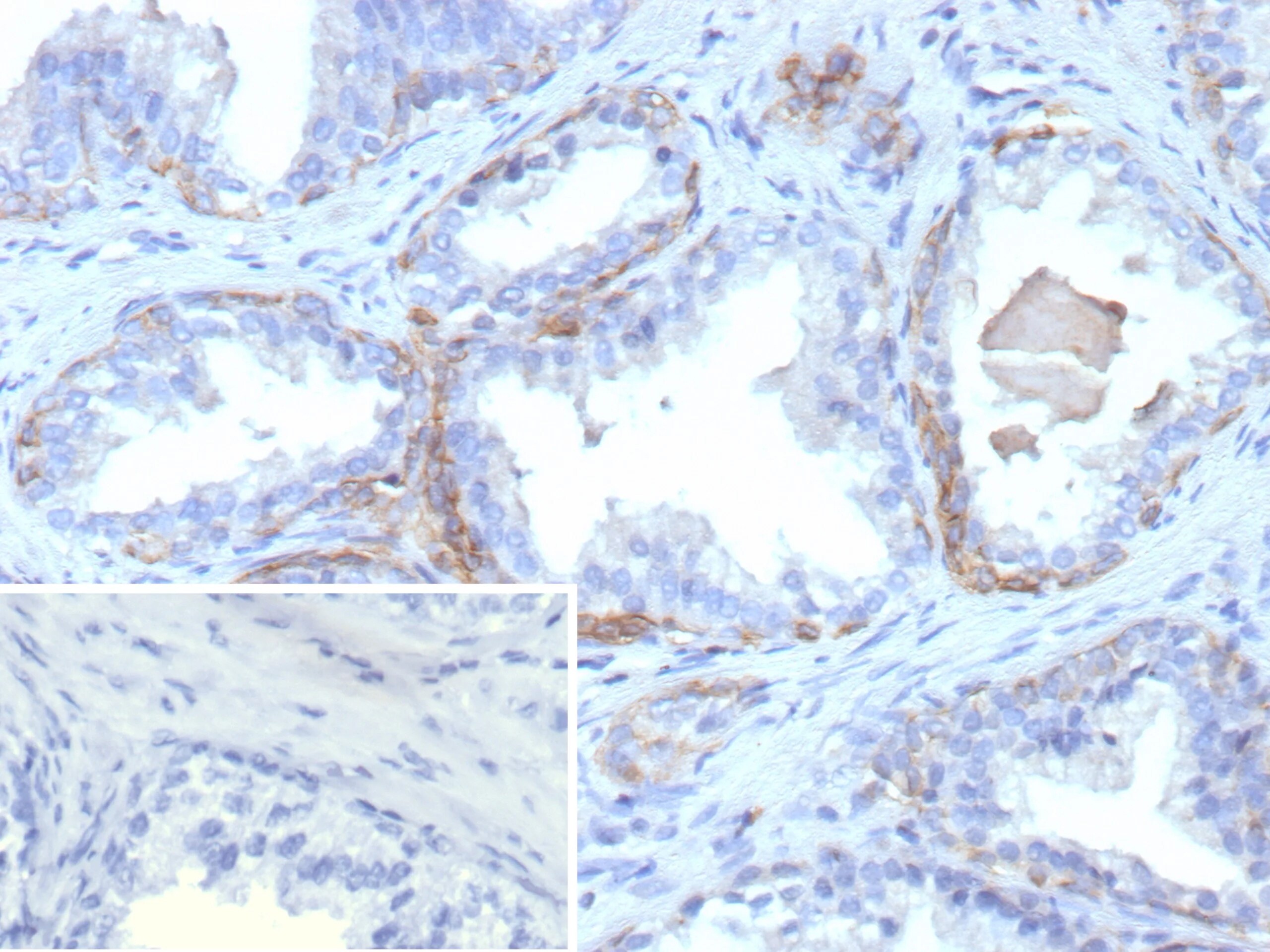 Cytokeratin 13 Antibody (rKRT13/9623) - Azide and BSA Free