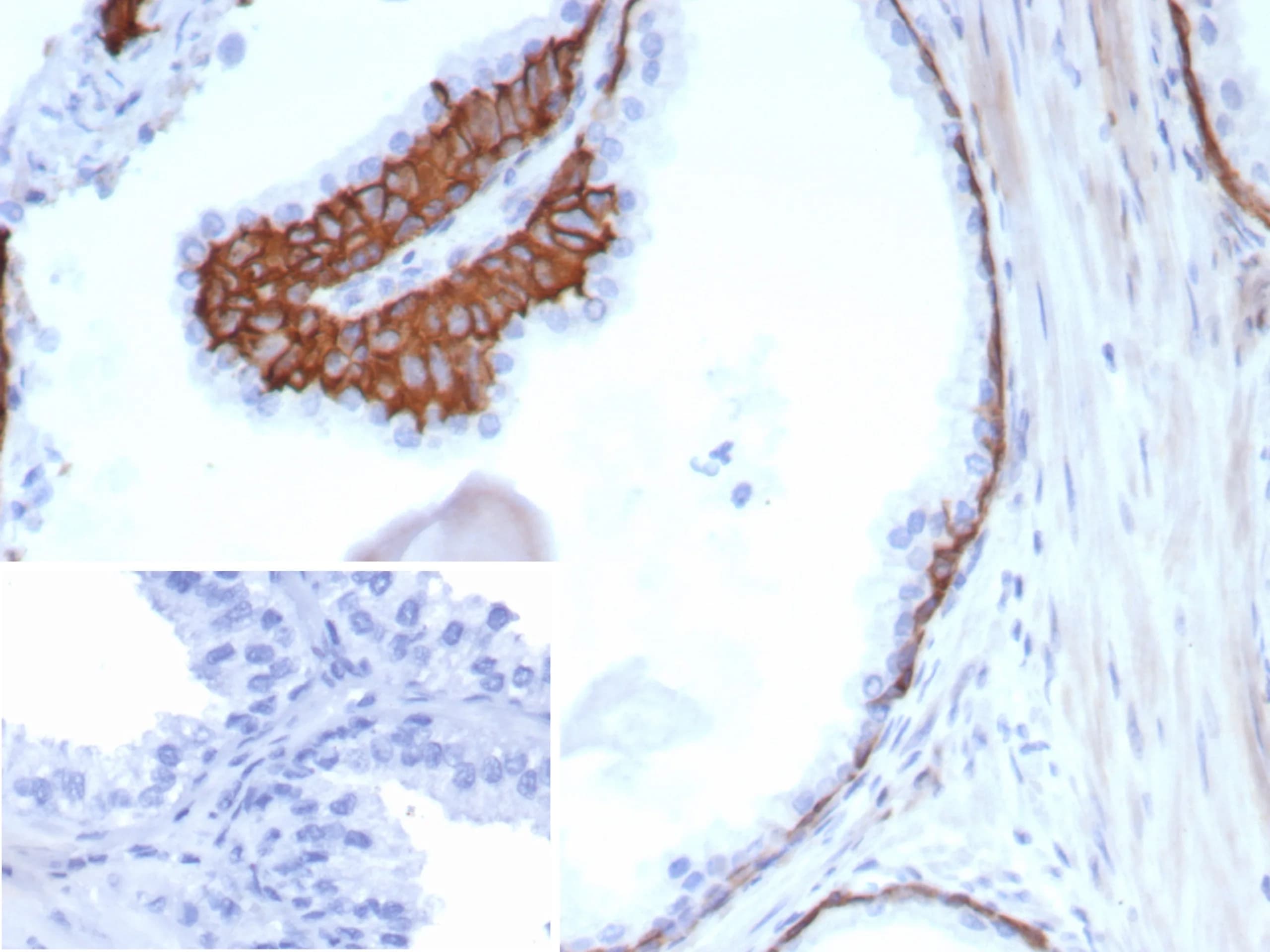 Cytokeratin 13 Antibody (KRT13/8577R) - Azide and BSA Free