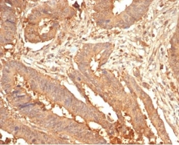 Galectin-3 Antibody (LGALS3/7036R) - Azide and BSA Free