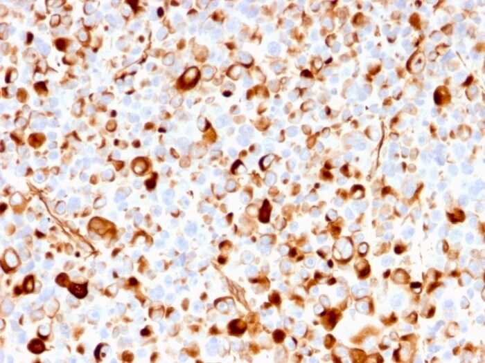NGFR/TNFRSF16/p75NTR Antibody (rNGFR/1965) - Azide and BSA Free