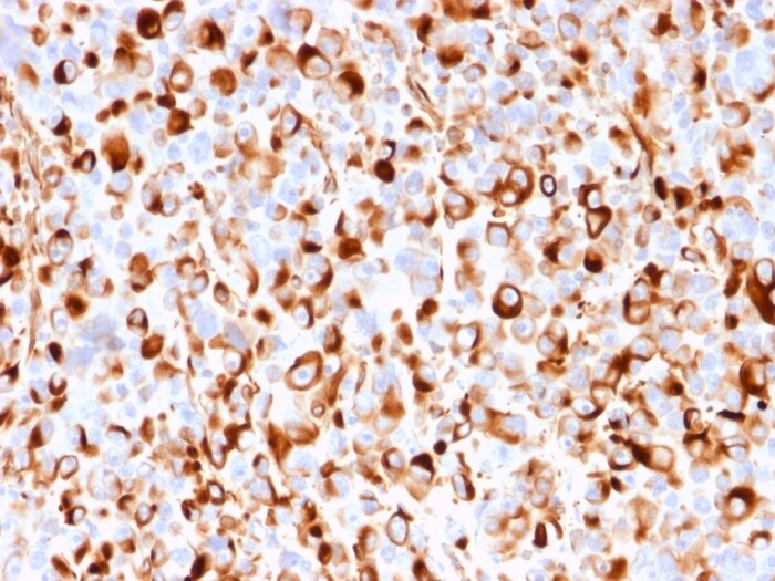 NGFR/TNFRSF16/p75NTR Antibody (rNGFR/1965) - Azide and BSA Free
