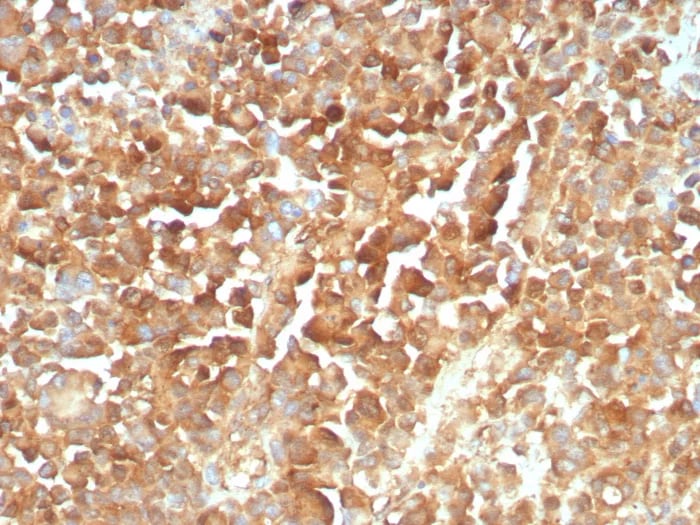 NGFR/TNFRSF16/p75NTR Antibody (rNGFR/8824) - Azide and BSA Free