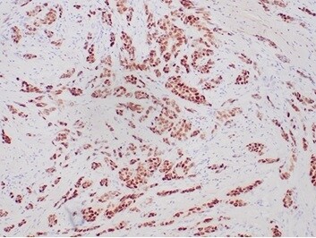 Progesterone R/NR3C3 Antibody (PGR/6854R) - Azide and BSA Free