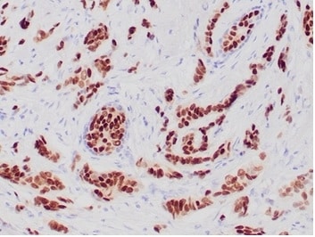Progesterone R/NR3C3 Antibody (PGR/6854R) - Azide and BSA Free