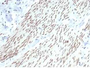 Progesterone R/NR3C3 Antibody (PGR/6854R) - Azide and BSA Free