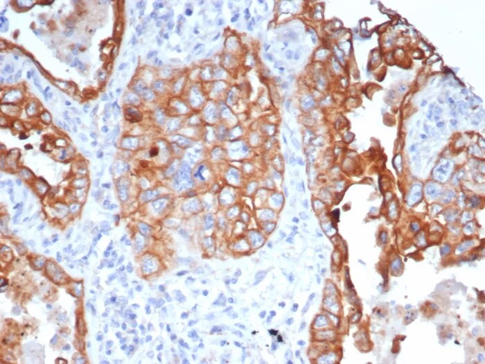 L1TD1 Antibody (L1TD1/7941) - Azide and BSA Free