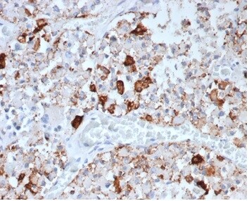 Prolactin Antibody (rPRL/4907) - Azide and BSA Free