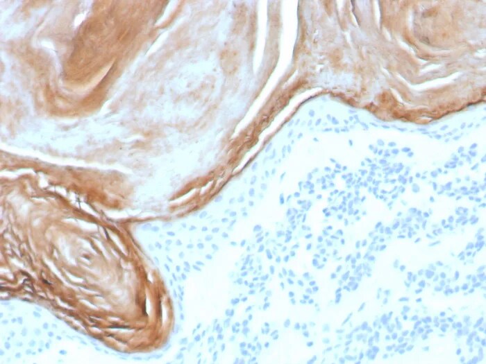 Kallikrein 7 Antibody (KLK7/8971R) - Azide and BSA Free