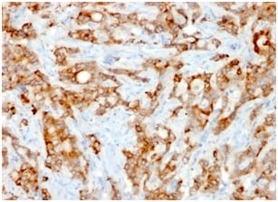 beta 2-Microglobulin Antibody (rB2M/961) - Azide and BSA Free