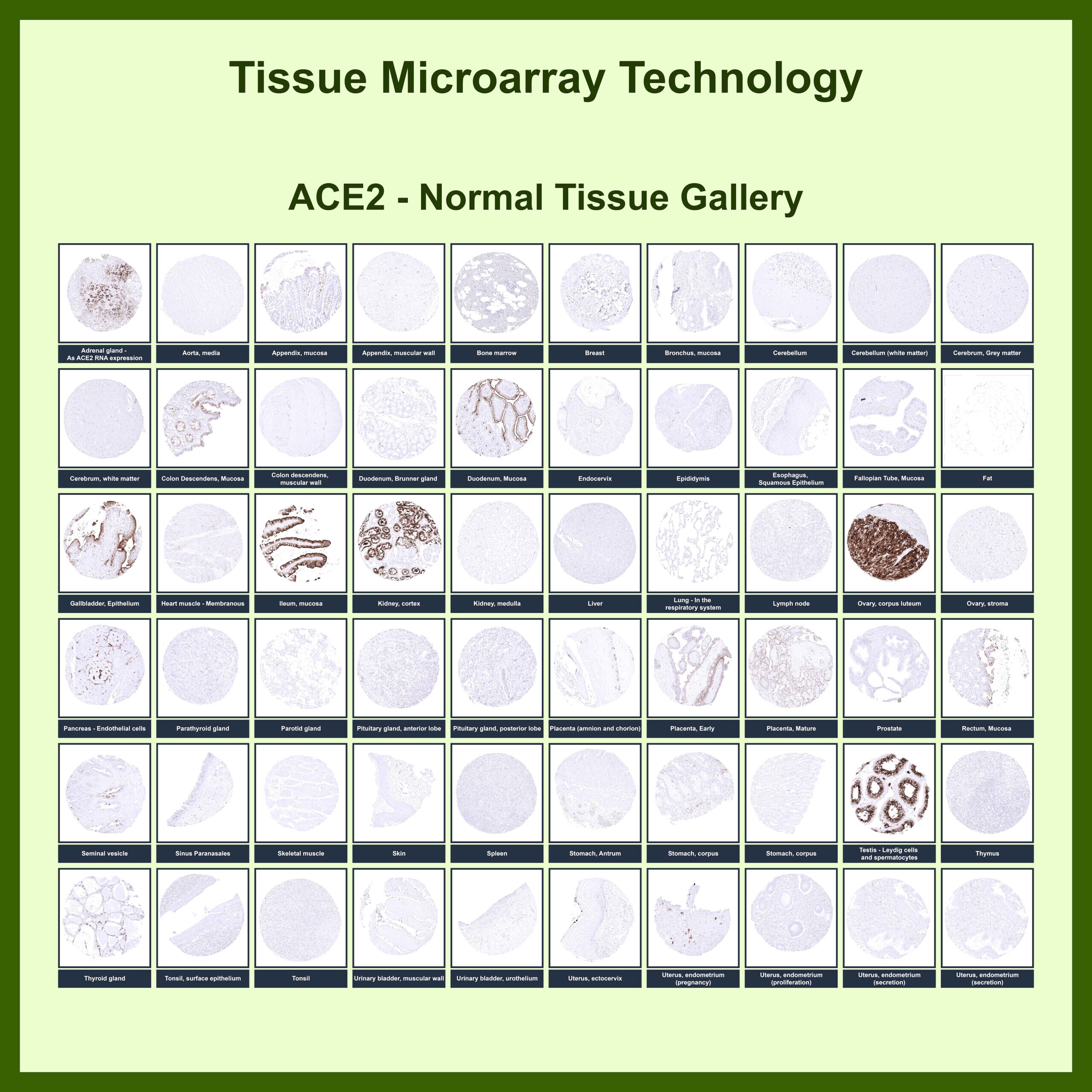 ACE-2 Antibody (ACE2/6788R) - Azide and BSA Free