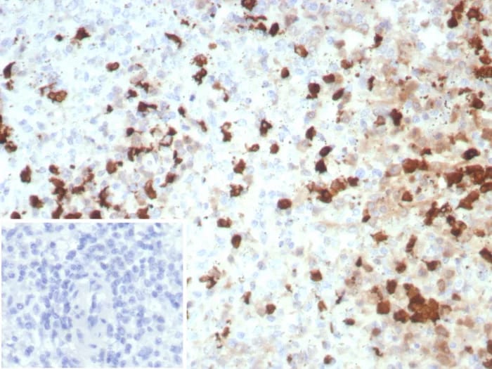 EN-RAGE/S100A12 Antibody (S100A12/8952R) - Azide and BSA Free