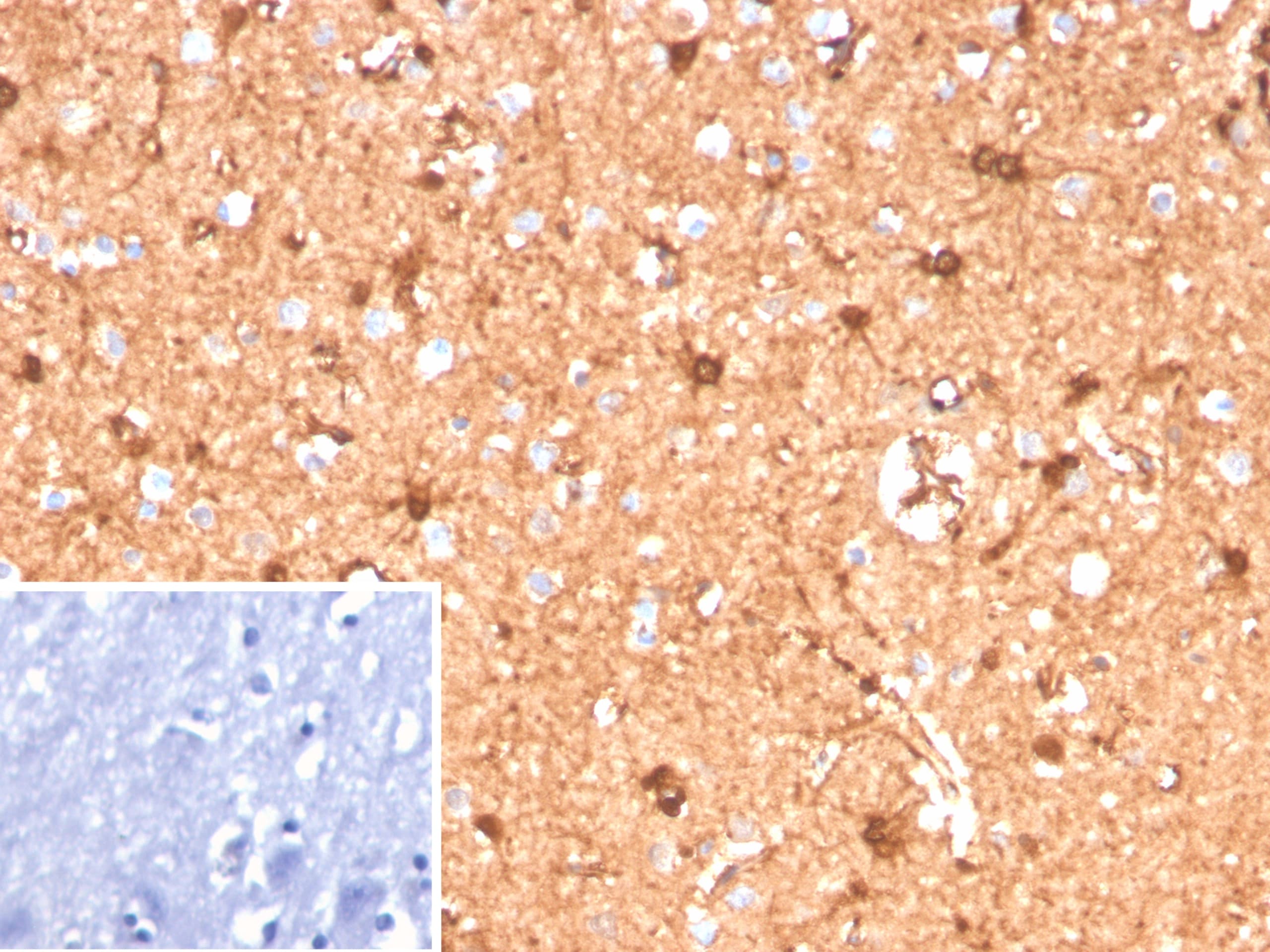 S100B Antibody (S100B/12587R) - Azide and BSA Free