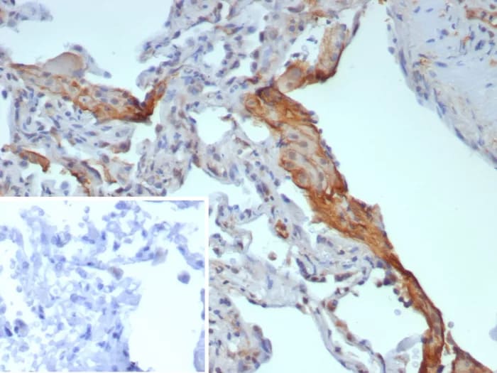 SP-D Antibody (rSFTPD/8064) - Azide and BSA Free