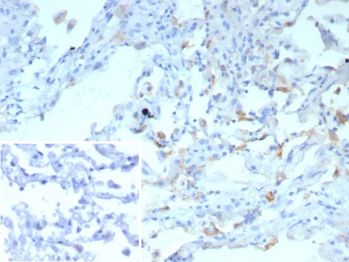 SP-D Antibody (rSFTPD/8065) - Azide and BSA Free