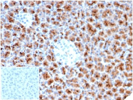 Fascin Antibody (rFSCN1/6464) - Azide and BSA Free