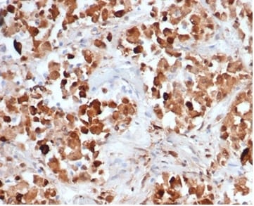 Growth Hormone Antibody (rGH/4887) - Azide and BSA Free