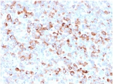 Tyrosinase Antibody (rOCA1/812) - Azide and BSA Free