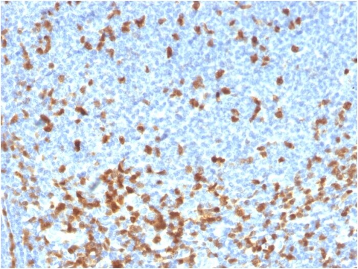 ZAP70 Antibody (rZAP70/2046) - Azide and BSA Free