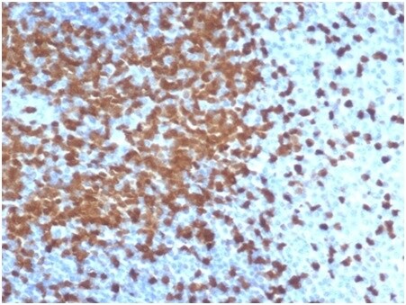 ZAP70 Antibody (ZAP70/6492R) - Azide and BSA Free