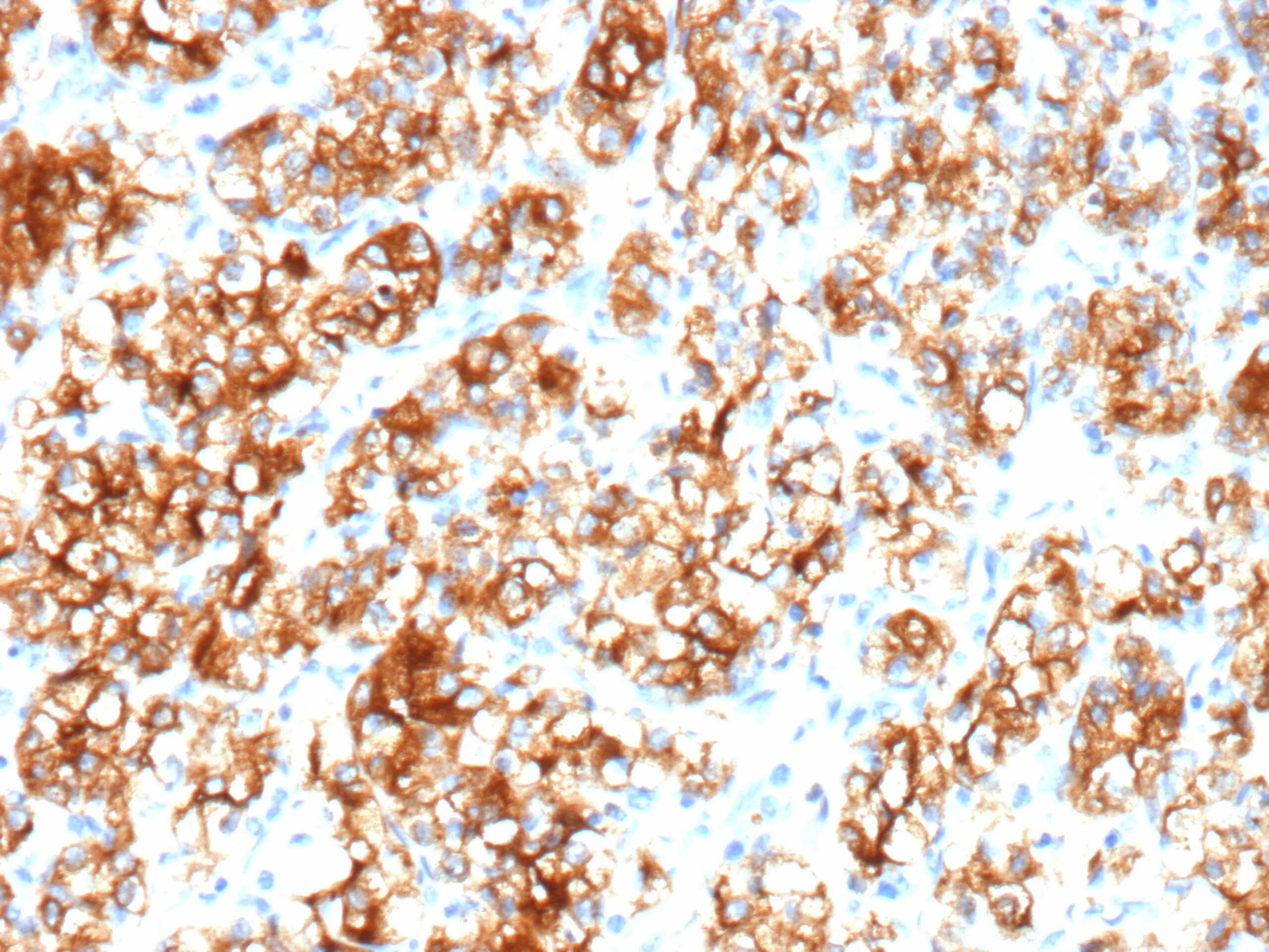 Carbonic Anhydrase IX/CA9 Antibody (rPN-15) - Azide and BSA Free