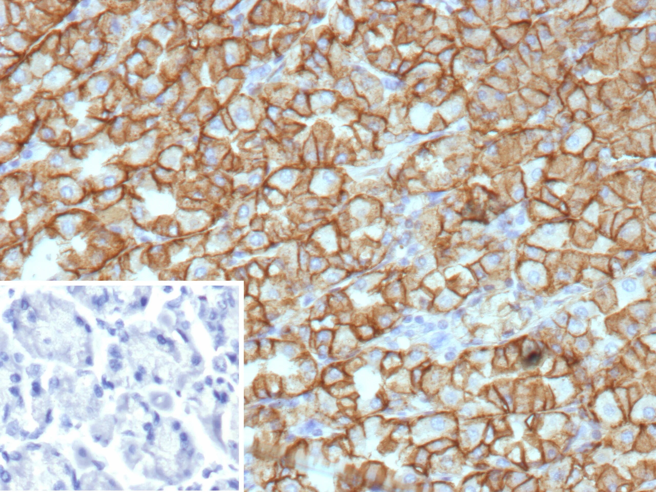 Carbonic Anhydrase IX/CA9 Antibody (rCA9/9937) - Azide and BSA Free